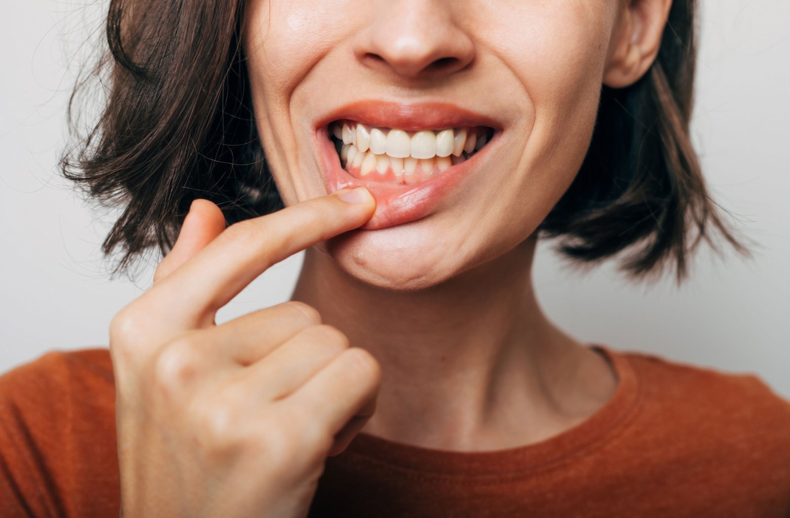 Woman pointing to her lower gums while smiling.