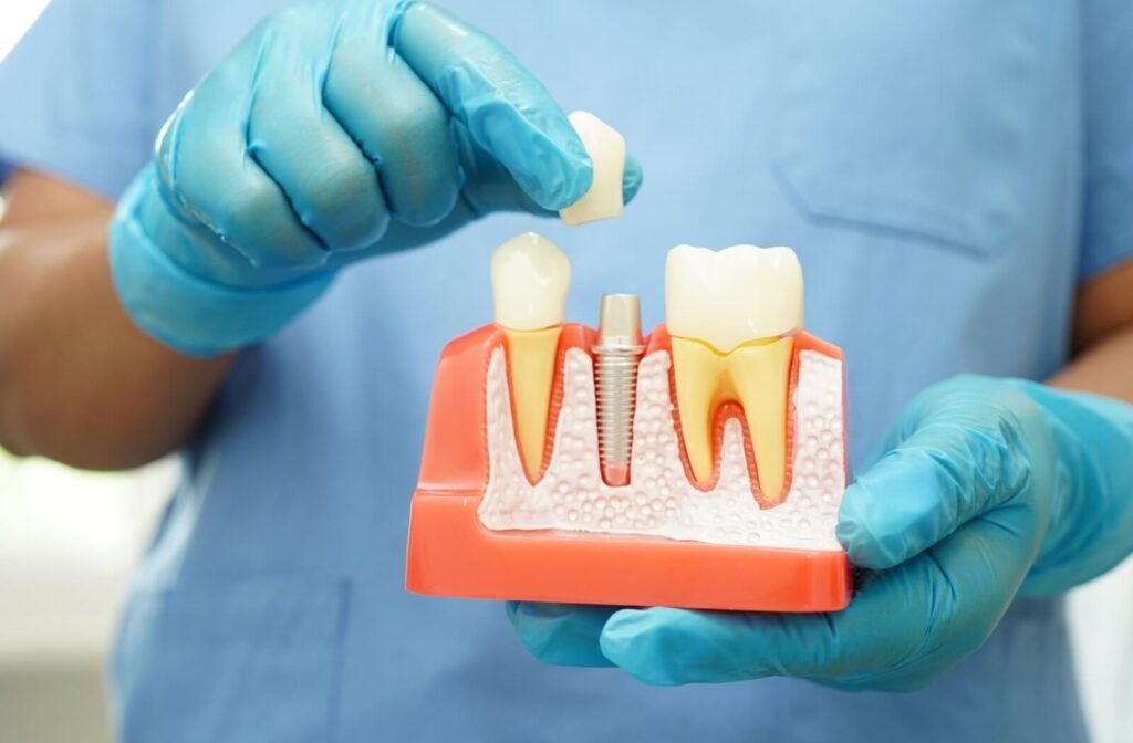Dentist showing how a crown fits on a tooth model.